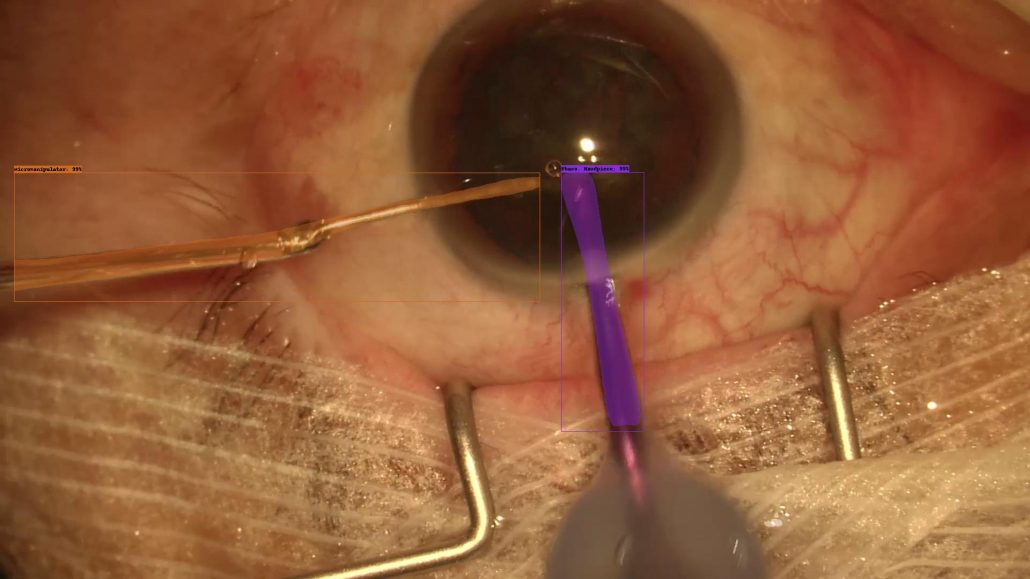 Pixel-Based Tool Segmentation in Cataract Surgery 